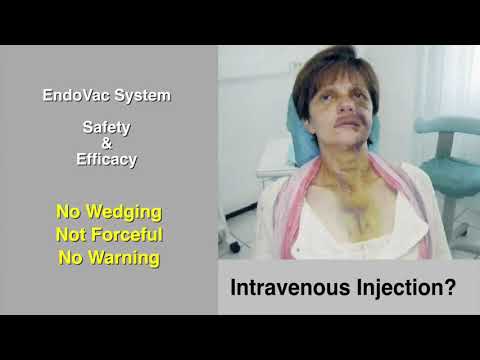 EndoVac™: #1 Safety & Efficacy