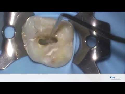 Quick Start Video #1: Access